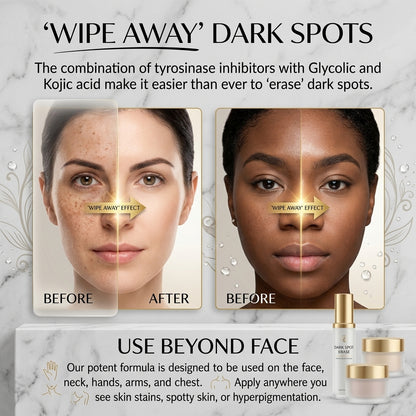 Dark Spot Corrector & Brightening Serum (30ml)