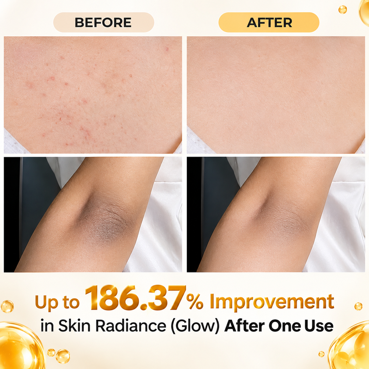 Melaxin - Peel Shot Kojic Acid Spray (200ml)