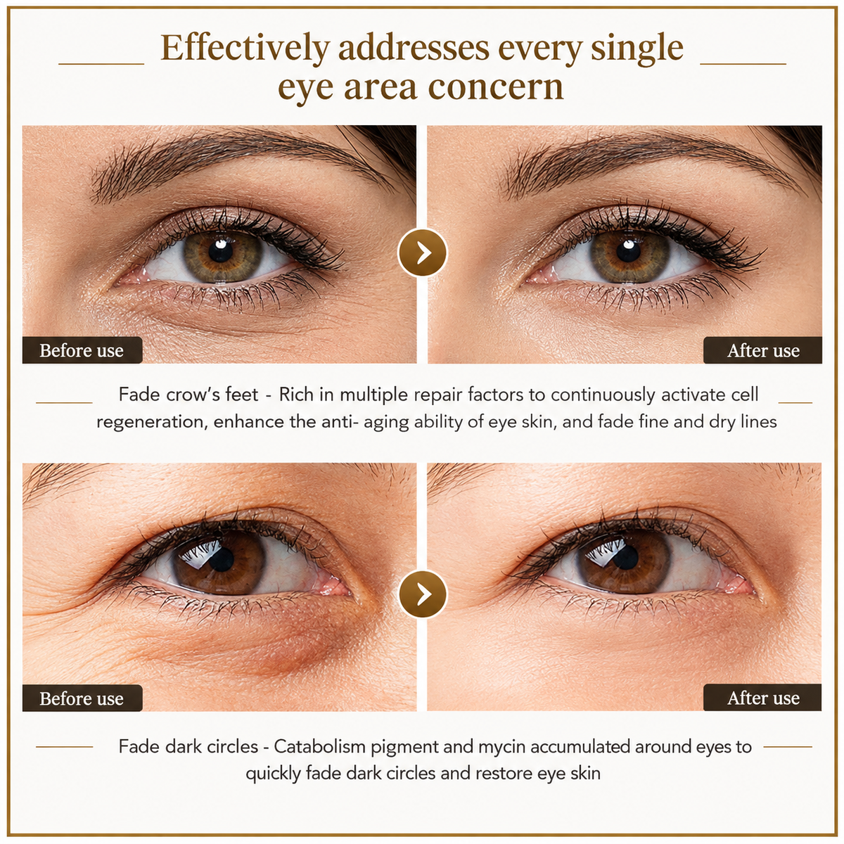 Time Eraser Eye Essence Oil – Anti-Aging & Dark Circle Treatment (10ml)