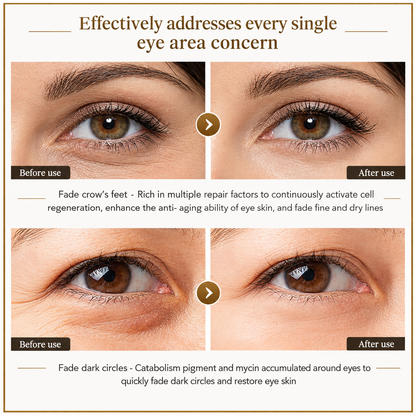 Time Eraser Eye Essence Oil – Anti-Aging & Dark Circle Treatment (10ml)